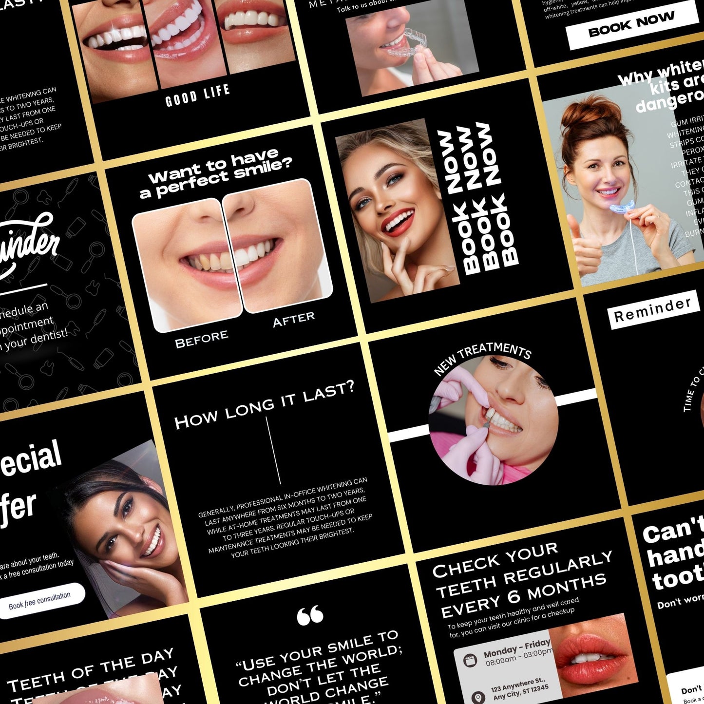 60 Teeth Whitening Social Media Post Template | Tooth Gem Instagram Templates