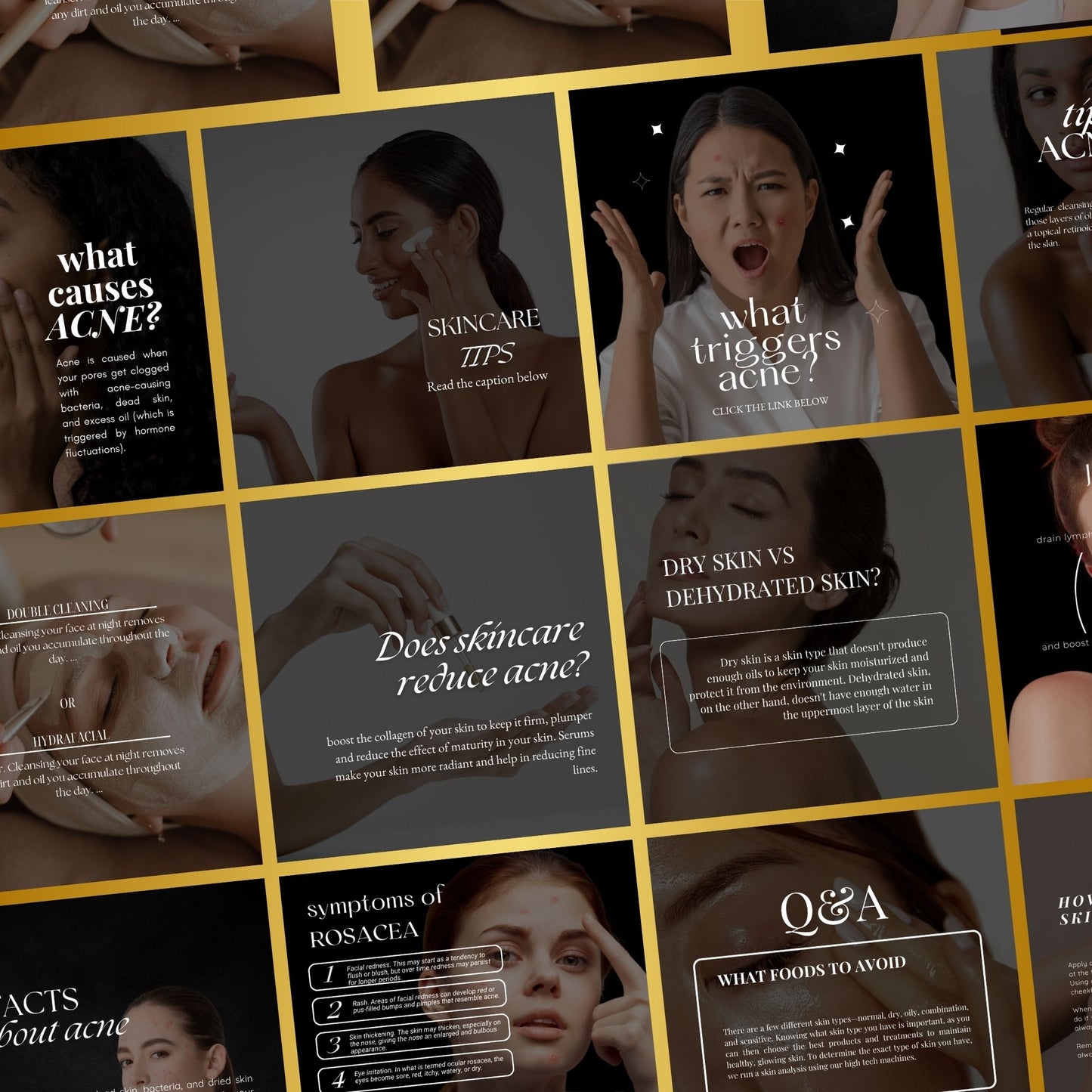 Skincare Social Media Templates | Esthetician Template