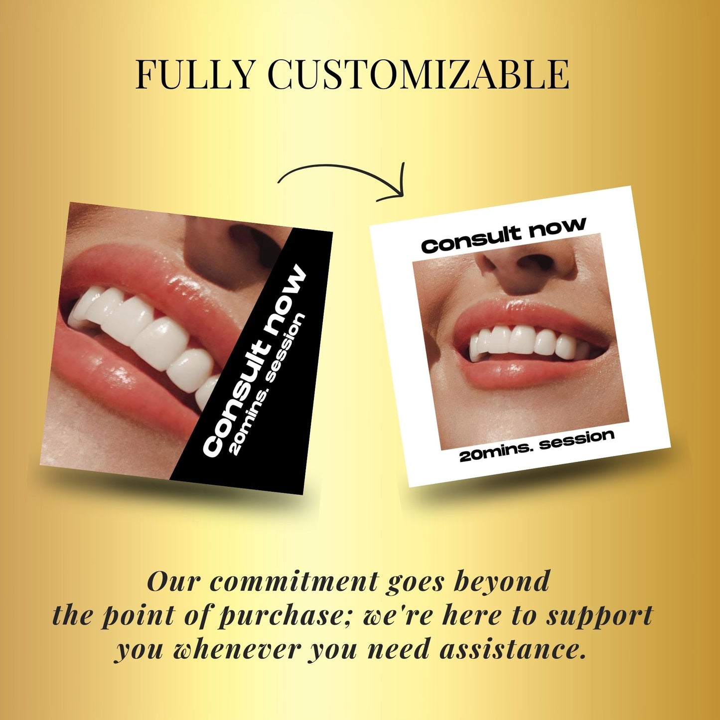 60 Teeth Whitening Social Media Post Template | Tooth Gem Instagram Templates